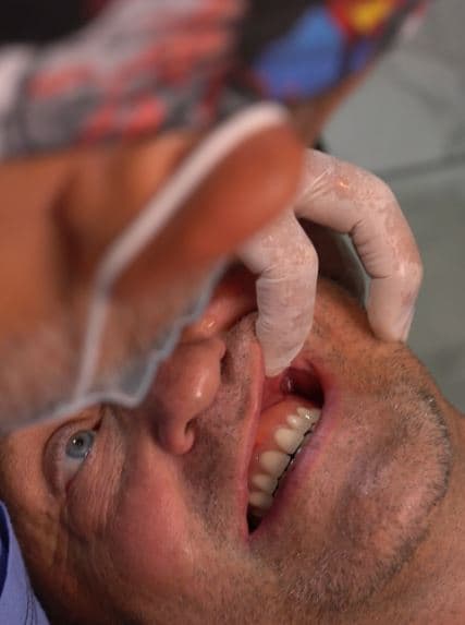 Marc, paciente canadiense del Dr. Zeus Rilo, durante una revisión post-implantes dentales